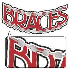 Braces foil laser die cut Braces foil laser die cut